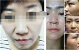 美博會結束后，奇緣玉凈在3月13日開展了斑痘敏安全修護的培訓公開課